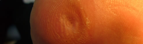 After treatment