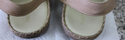 Heel Fissures (cracked heels)