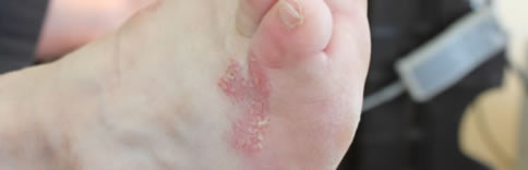 Dermatological Foot Screen